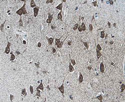 XIAP was detected in immersion fixed paraffin-embedded sections of human brain (cortex) using 25 µg/mL Mouse Anti-Human XIAP Monoclonal Antibody (Catalog # MAB8221) overnight at 4 °C. Tissue was stained with the Anti-Mouse HRP-DAB Cell & Tissue Staining Kit (brown; Catalog # CTS002) and counter-stained with hematoxylin (blue). View our protocol for Chromogenic IHC Staining of Paraffin-embedded Tissue Sections.
