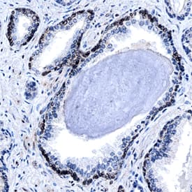 YAP1 was detected in formalin fixed paraffin-embedded sections of human prostate using Mouse Anti-Human YAP1 Monoclonal Antibody (Catalog # MAB8094) at 15 µg/mL overnight at 4 °C. Before incubation with the primary antibody, tissue was subjected to heat-induced epitope retrieval using Antigen Retrieval Reagent-Basic (Catalog # CTS013). Tissue was stained using the Anti-Mouse HRP-DAB Cell & Tissue Staining Kit (brown; Catalog # CTS002) and counterstained with hematoxylin (blue). Specific staining was localized to the nuclei of smooth muscle cells. View our protocol for Chromogenic IHC Staining of Paraffin-embedded Tissue Sections.
