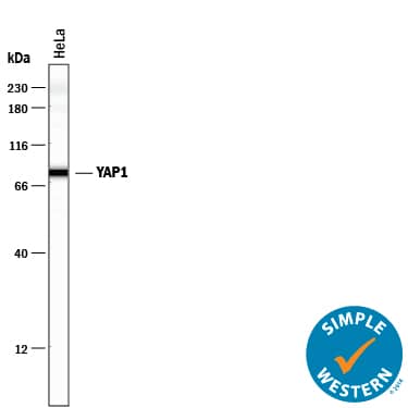 Simple Western lane view shows lysates of HeLa human cervical epithelial carcinoma cell line, loaded at 0.5 mg/mL. A specific band was detected for YAP1 at approximately 79 kDa (as indicated) using 20 µg/mL of Mouse Anti-Human/Mouse/Rat YAP1 Monoclonal Antibody (Catalog # MAB8094) . This experiment was conducted under reducing conditions and using the 12-230 kDa separation system.