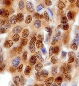YY1 was detected in immersion fixed paraffin-embedded sections of human breast using Goat Anti-Human YY1 Antigen Affinity-purified Polyclonal Antibody (Catalog # AF3784) at 1 µg/mL overnight at 4 °C. Before incubation with the primary antibody, tissue was subjected to heat-induced epitope retrieval using Antigen Retrieval Reagent-Basic (Catalog # CTS013). Tissue was stained using the Anti-Goat HRP-DAB Cell & Tissue Staining Kit (brown; Catalog # CTS008) and counter-stained with hematoxylin (blue). Specific staining was localized to nuclei. View our protocol for Chromogenic IHC Staining of Paraffin-embedded Tissue Sections.