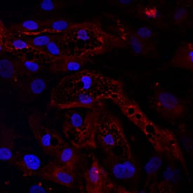 ZAG was detected in immersion fixed human mesenchymal stem cells differentiated into adipocytes using Goat Anti-Human ZAG Antigen Affinity-purified Polyclonal Antibody (Catalog # AF4764) at 10 µg/mL for 3 hours at room temperature. Cells were differentiated using using StemXVivo Osteogenic/Adipogenic Base Media (Catalog # CCM007) and StemXVivo Adipogenic Supplement (100X) (Catalog # CCM011). Cells were stained using the NorthernLights™ 557-conjugated Anti-Goat IgG Secondary Antibody (red; Catalog # NL001) and counterstained with DAPI (blue). Specific staining was localized to cytoplasm. View our protocol for Fluorescent ICC Staining of Stem Cells on Coverslips.