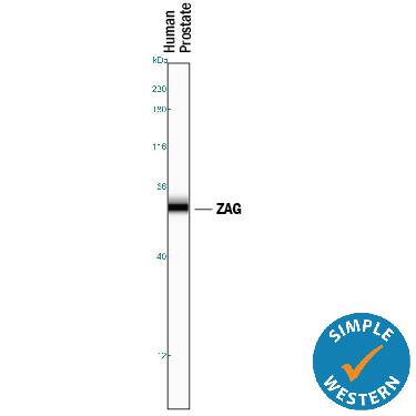 Simple Western lane view shows lysates of human prostate tissue, loaded at 0.2 mg/mL. A specific band was detected for ZAG at approximately 59 kDa (as indicated) using 10 µg/mL of Mouse Anti-Human ZAG Monoclonal Antibody (Catalog # MAB4764). This experiment was conducted under reducing conditions and using the 12-230 kDa separation system.