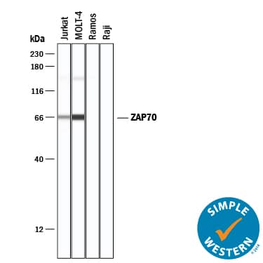 Simple Western ZAP70 Antibody [Unconjugated]