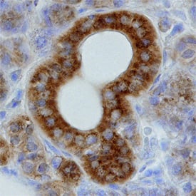 Immunohistochemistry ZAP70 Antibody [Unconjugated]