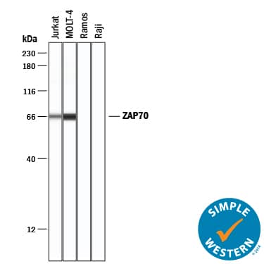 Simple Western ZAP70 Antibody [Unconjugated]