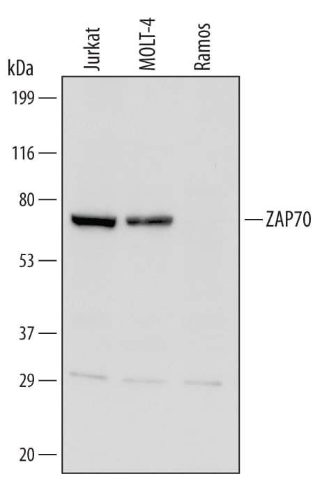 Western Blot ZAP70 Antibody [Unconjugated]