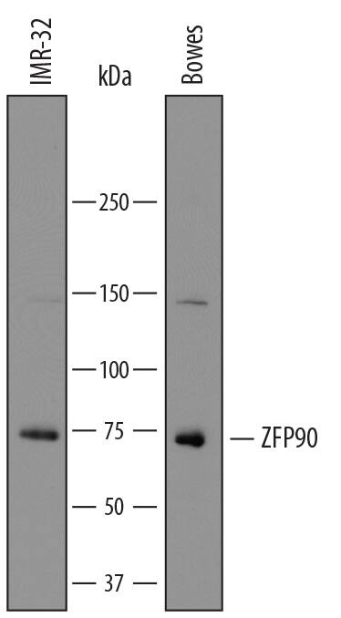 Western blot shows lysates of IMR-32 human neuroblastoma cell line and Bowes human melanoma cell line. PVDF membrane was probed with 1 µg/mL of Sheep Anti-Human ZFP90 Antigen Affinity-purified Polyclonal Antibody (Catalog # AF7870) followed by HRP-conjugated Anti-Sheep IgG Secondary Antibody (Catalog # HAF016). A specific band was detected for ZFP90 at approximately 72 kDa (as indicated). This experiment was conducted under reducing conditions and using Immunoblot Buffer Group 1.