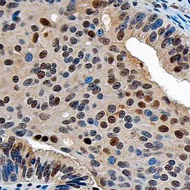 ZMIZ1/Zimp10 was detected in immersion fixed paraffin-embedded sections of human ovary using Sheep Anti-Human ZMIZ1/Zimp10 Antigen Affinity-purified Polyclonal Antibody (Catalog # AF8107) at 5 µg/mL overnight at 4 °C. Tissue was stained using the Anti-Sheep HRP-DAB Cell & Tissue Staining Kit (brown; Catalog # CTS019) and counterstained with hematoxylin (blue). Specific staining was localized to nuclei. View our protocol for Chromogenic IHC Staining of Paraffin-embedded Tissue Sections.