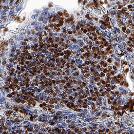ZNF10 was detected in immersion fixed paraffin-embedded sections of human tonsil using Mouse Anti-Human ZNF10 Monoclonal Antibody (Catalog # MAB96561) at 5 µg/mL for 1 hour at room temperature followed by incubation with the Anti-Mouse IgG VisUCyte™ HRP Polymer Antibody (Catalog # VC001). Tissue was stained using DAB (brown) and counterstained with hematoxylin (blue). Specific staining was localized to cell nuclei. View our protocol for IHC Staining with VisUCyte HRP Polymer Detection Reagents.