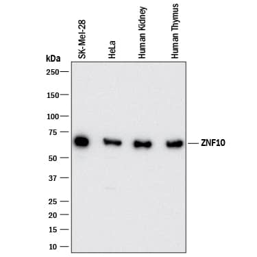 Western blot shows lysates of SK-Mel-28 human malignant melanoma cell line, HeLa human cervical epithelial carcinoma cell line, human kidney tissue, and human thymus tissue. PVDF membrane was probed with 0.5 µg/mL of Mouse Anti-Human ZNF10 Monoclonal Antibody (Catalog # MAB9656) followed by HRP-conjugated Anti-Mouse IgG Secondary Antibody (Catalog # HAF018). A specific band was detected for ZNF10 at approximately 70 kDa (as indicated). This experiment was conducted under reducing conditions and using Immunoblot Buffer Group 1.