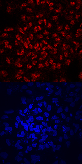 ZNF143 was detected in immersion fixed BG01V human embryonic stem cells using Mouse Anti-Human ZNF143 Monoclonal Antibody (Catalog # MAB6804) at 10 µg/mL for 3 hours at room temperature. Cells were stained using the NorthernLights™ 557-conjugated Anti-Mouse IgG Secondary Antibody (red, upper panel; Catalog # NL007) and counterstained with DAPI (blue, lower panel). Specific staining was localized to nuclei. View our protocol for Fluorescent ICC Staining of Cells on Coverslips.
