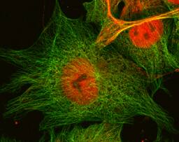 Immunocytochemistry ZNF206 Antibody [Unconjugated]