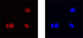 ZNF24 was detected in immersion fixed HepG2 human hepatocellular carcinoma cell line using Goat Anti-Human ZNF24 Antigen Affinity-purified Polyclonal Antibody (Catalog # AF3637) at 15 µg/mL for 3 hours at room temperature. Cells were stained using the NorthernLights™ 557-conjugated Anti-Goat IgG Secondary Antibody (left panel, red; Catalog # NL001) and counterstained with DAPI (right panel, blue). Specific staining was localized to nuclei. View our protocol for Fluorescent ICC Staining of Cells on Coverslips.