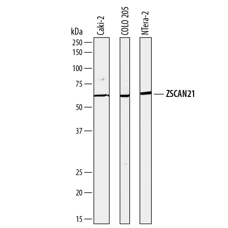 Western blot shows lysates of Caki-2 human clear cell carcinoma epithelial cell line, COLO 205 human colorectal adenocarcinoma cell line, and NTera-2 human testicular embryonic carcinoma cell line. PVDF membrane was probed with 2 µg/mL of Sheep Anti-Human ZSCAN21 Antigen Affinity-purified Polyclonal Antibody (Catalog # AF8015) followed by HRP-conjugated Anti-Sheep IgG Secondary Antibody (Catalog # HAF016). A specific band was detected for ZSCAN21 at approximately 60 kDa (as indicated). This experiment was conducted under reducing conditions and using Immunoblot Buffer Group 8.