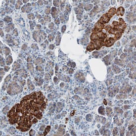 ZnT-8 was detected in immersion fixed paraffin-embedded sections of human pancreas using Sheep Anti-Human ZnT-8 Antigen Affinity-purified Polyclonal Antibody (Catalog # AF7318) at 3 µg/mL overnight at 4 °C. Before incubation with the primary antibody, tissue was subjected to heat-induced epitope retrieval using Antigen Retrieval Reagent-Basic (Catalog # CTS013). Tissue was stained using the Anti-Sheep HRP-DAB Cell & Tissue Staining Kit (brown; Catalog # CTS019) and counterstained with hematoxylin (blue). Specific staining was localized to islet cells. View our protocol for Chromogenic IHC Staining of Paraffin-embedded Tissue Sections.