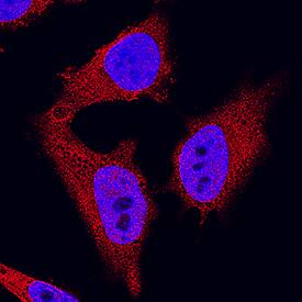 Zyxin was detected in immersion fixed A549 human lung carcinoma cell line using Mouse Anti-Human/Mouse/Rat Zyxin Monoclonal Antibody (Catalog # MAB6977) at 3 µg/mL for 3 hours at room temperature. Cells were stained using the NorthernLights™ 557-conjugated Anti-Mouse IgG Secondary Antibody (red; Catalog # NL007) and counterstained with DAPI (blue). Specific staining was localized to cytoplasm and nuclei. View our protocol for Fluorescent ICC Staining of Cells on Coverslips.