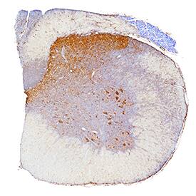 Zyxin was detected in perfusion fixed frozen sections of rat spinal cord using Mouse Anti-Human/Mouse/Rat Zyxin Monoclonal Antibody (Catalog # MAB6977) at 3 µg/mL for 1 hour at room temperature followed by incubation with the Anti-Mouse IgG VisUCyte™ HRP Polymer Antibody (Catalog # VC001). Tissue was stained using DAB (brown) and counterstained with hematoxylin (blue). Specific staining was localized to motor neurons and dorsal horn. View our protocol for IHC Staining with VisUCyte HRP Polymer Detection Reagents.