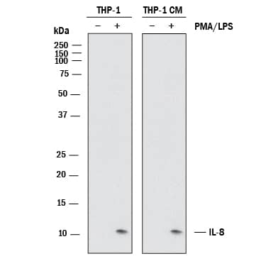 Western Blot CXCL8/IL-8 Antibody [Unconjugated]