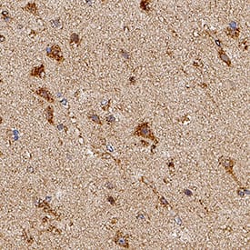Immunohistochemistry TGF-beta 3 Antibody [Unconjugated]