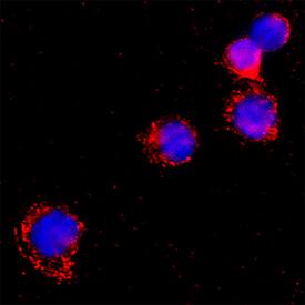 LAP (TGF-beta 1) was detected in immersion fixed Human peripheral blood mononuclear cells using Goat Anti-Human LAP (TGF-beta 1) Antigen Affinity-purified Polyclonal Antibody (Catalog # AF-246-NA) at 15 &micro;g/mL for 3 hours at room temperature. Cells were stained using the NorthernLights&trade; 557-conjugated Anti-Goat IgG Secondary Antibody (red; NL001) and counterstained with DAPI (blue). Specific staining was localized to cytoplasm. Staining was performed using our protocol for Fluorescent ICC Staining of Non-adherent Cells.