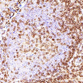CD4 was detected in immersion fixed paraffin-embedded sections of human tonsil tissue using Goat Anti-Human CD4 Antigen Affinity-purified Polyclonal Antibody (Catalog # AF-379-NA) at 1.7 &micro;g/mL for 1 hour at room temperature followed by incubation with the Anti-Goat IgG VisUCyte&trade; HRP Polymer Antibody (VC004). Before incubation with the primary antibody, tissue was subjected to heat-induced epitope retrieval using Antigen Retrieval Reagent-Basic (CTS013). Tissue was stained using DAB (brown) and counterstained with hematoxylin (blue). Specific staining was localized to cell surface of lymphocytes. Staining was performed using our IHC Staining with VisUCyte HRP Polymer Detection Reagents protocol.