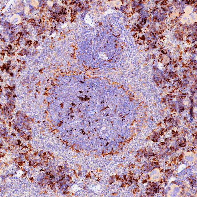 EphA2‐Dependent tumor induction of osteoclast differentiation requires IL‐6. (A) ELISA analysis for IL‐6 protein levels in conditioned media harvested from  4T1. delta C cells relative to 4T1.V controls (p VCTS021). Tissue was stained using the HRP-conjugated Anti-Goat IgG Secondary Antibody (Catalog # HAF017) and counterstained with hematoxylin (blue). Specific staining was localized to the cytoplasm. View our protocol for Chromogenic IHC Staining of Paraffin-embedded Tissue Sections.