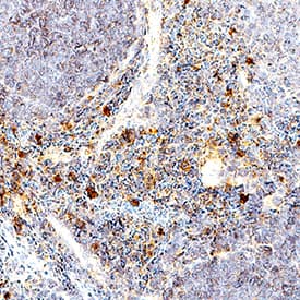 Immunohistochemistry TNF-alpha Antibody [Unconjugated]