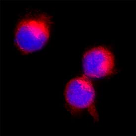 Immunocytochemistry TNF RII/TNFRSF1B Antibody [Unconjugated]