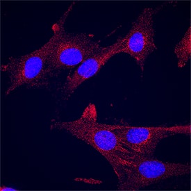 Immunocytochemistry Notch-1 Antibody [Unconjugated]