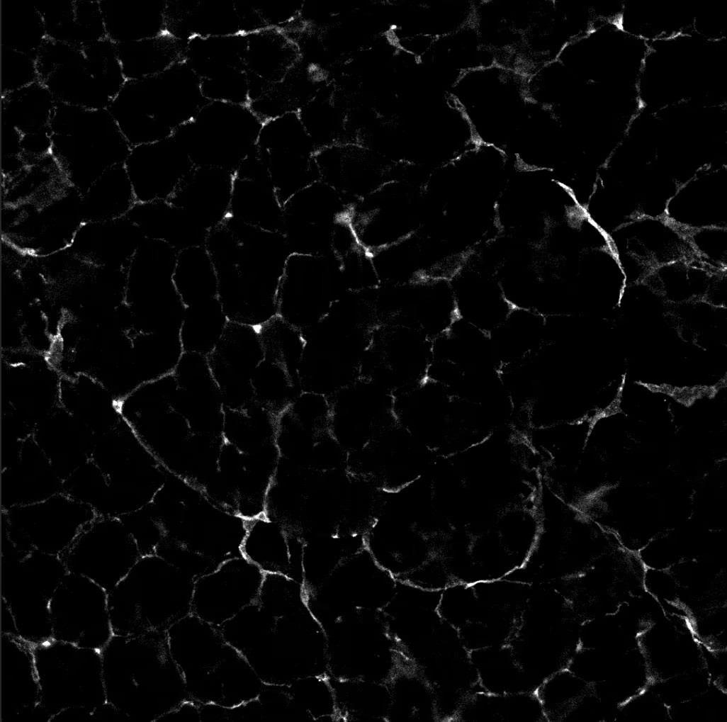 Immunohistochemistry PDGFR alpha Antibody [Unconjugated]