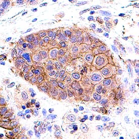 Immunohistochemistry EGFR [p Tyr1173] Antibody [Unconjugated]