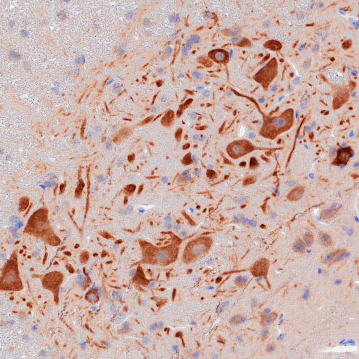N/A Neprilysin/CD10 Antibody [Unconjugated]