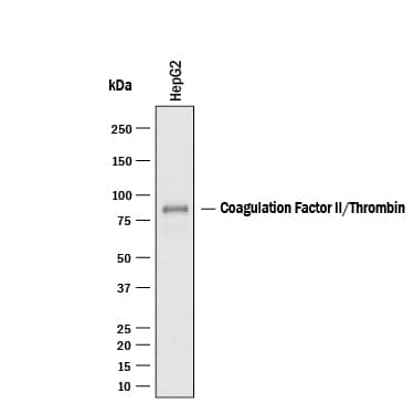 Western blot shows lysates of HepG2 human hepatocellular carcinoma cell line. PVDF membrane was probed with 0.1 µg/mL of Goat Anti-Human Coagulation Factor II/Thrombin Antigen Affinity-purified Polyclonal Antibody (Catalog # AF1148) followed by HRP-conjugated Anti-Goat IgG Secondary Antibody (Catalog # HAF017). A specific band was detected for Coagulation Factor II/Thrombin at approximately 75 kDa (as indicated). This experiment was conducted under reducing conditions and using Western Blot Buffer Group 1.