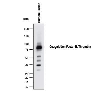 Western blot shows human plasma. PVDF membrane was probed with 0.1 µg/mL of Goat Anti-Human Coagulation Factor II/Thrombin Antigen Affinity-purified Polyclonal Antibody (Catalog # AF1148) followed by HRP-conjugated Anti-Goat IgG Secondary Antibody (HAF017). A specific band was detected for Coagulation Factor II/Thrombin at approximately 75 kDa (as indicated). This experiment was conducted under reducing conditions and using Western Blot Buffer Group 1.