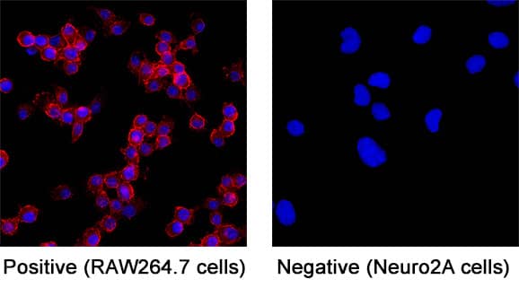 Immunocytochemistry CD45 Antibody [Unconjugated]