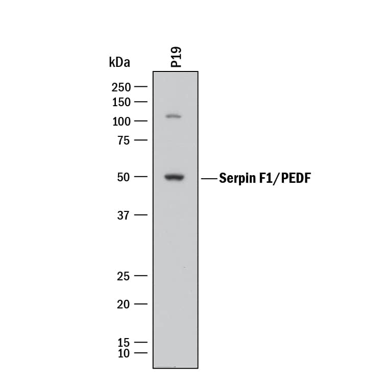 Western blot shows lysates of P19 mouse embryonal carcinoma cell line. PVDF membrane was probed with 2 µg/mL of Goat Anti-Human/Mouse Serpin F1/PEDF Antigen Affinity-purified Polyclonal Antibody (Catalog # AF1177) followed by HRP-conjugated Anti-Goat IgG Secondary Antibody (Catalog # HAF017). A specific band was detected for Serpin F1/PEDF at approximately 50 kDa (as indicated). This experiment was conducted under reducing conditions and using Immunoblot Buffer Group 1.