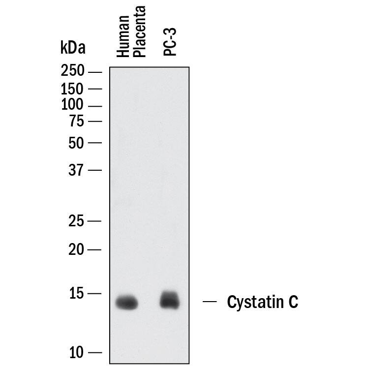 Western blot shows lysates of human placenta tissue and PC-3 human prostate cancer cell line. PVDF membrane was probed with 2 µg/mL of Goat Anti-Human Cystatin C Antigen Affinity-purified Polyclonal Antibody (Catalog # AF1196) followed by HRP-conjugated Anti-Goat IgG Secondary Antibody (Catalog # HAF017). A specific band was detected for Cystatin C at approximately 14 kDa (as indicated). This experiment was conducted under reducing conditions and using Immunoblot Buffer Group 1.