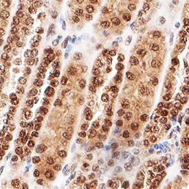 Immunohistochemistry MDM2/HDM2 Antibody [Unconjugated]