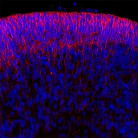 Immunofluorescence Notch-3 Antibody [Unconjugated]