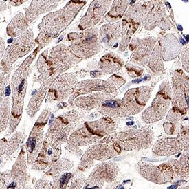 N-Cadherin was detected in immersion fixed paraffin-embedded sections of human heart using Sheep Anti-Human N-Cadherin Antigen Affinity-purified Polyclonal Antibody (Catalog # AF1388) at 1 µg/mL overnight at 4 °C. Tissue was stained using the Sheep IgG VisUCyte HRP Polymer Antibody (Catalog # VC006). Before incubation with the primary antibody, tissue was subjected to heat-induced epitope retrieval using Antigen Retrieval Reagent-Basic (Catalog # CTS013). Tissue was stained using DAB (brown) and counterstained with hematoxylin (blue). Specific staining was localized to intercalated disks between the myocardial cells. Staining was performed using our protocol for IHC Staining with VisUCyte HRP Polymer Detection Reagents.