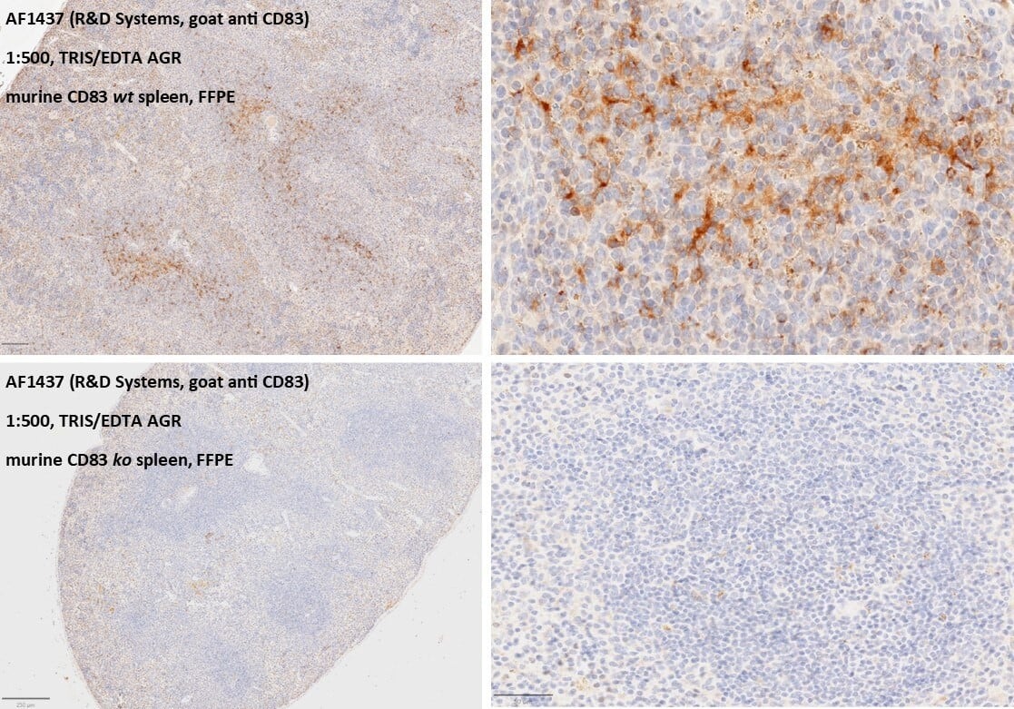 Dilution: 1:500. AGR with Tris/EDTA pH 9.0 for 10min. Serum blocking with normal rabbit serum (5% for 1hour). anti-CD83 incubation for 16h at 4°C overnight. Secondary antibody: rabbit anti goat IgG Biotin. DAB. Image from a verified customer review.