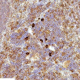 Immunohistochemistry TIM-3 Antibody [Unconjugated]