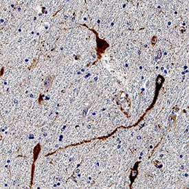 CART was detected in immersion fixed paraffin-embedded sections of human brain (Hypothalamus) tissue using Goat Anti-Human/Mouse/Rat CART Antigen Affinity-purified Polyclonal Antibody (Catalog # AF163) at 1 µg/mL for 1 hour at room temperature followed by incubation with the Anti-Goat IgG VisUCyte™ HRP Polymer Antibody (VC004). Tissue was stained using DAB (brown) and counterstained with hematoxylin (blue). Specific staining was localized to neurons. Staining was performed using our IHC Staining with VisUCyte HRP Polymer Detection Reagents.