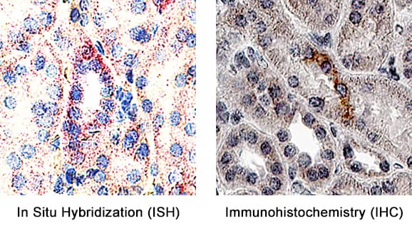 Formalin-fixed paraffin-embedded tissue sections of human kidney were probed for TIM1 mRNA (ACD RNAScope Probe, catalog #452148; Fast Red chromogen, ACD catalog # 322750). Adjacent tissue section was processed for immunohistochemistry using goat anti-human TIM1 polyclonal antibody (R&D Systems catalog # AF1750) at 1ug/mL with 1 hour incubation at room temperature followed by incubation with anti-goat IgG VisUCyte HRP Polymer Antibody (Catalog # VC004) and DAB chromogen (yellow-brown). Tissue was counterstained with hematoxylin (blue). Specific staining was localized to tubules. 