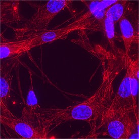 Integrin  beta 1/CD29 was detected in immersion fixed A549 human lung carcinoma cell line using Goat Anti-Human/Canine Integrin  beta 1/CD29 Antigen Affinity-purified Polyclonal Antibody (Catalog # AF1778) at 5 &micro;g/mL for 3 hours at room temperature. Cells were stained using the NorthernLights&trade; 557-conjugated Anti-Goat IgG Secondary Antibody (red; NL001) and counterstained with DAPI (blue). Specific staining was localized to cytoplasm. Staining was performed using our protocol for Fluorescent ICC Staining of Non-adherent Cells.