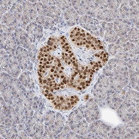 Immunohistochemistry Islet-1 Antibody [Unconjugated]