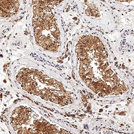 Nanog was detected in immersion fixed paraffin-embedded sections of normal human testis using Goat Anti-Human Nanog Antigen Affinity-purified Polyclonal Antibody (Catalog # AF1997) at 1 &micro;g/mL for 1 hour at room temperature followed by incubation with the Anti-Goat IgG VisUCyte&trade; HRP Polymer Antibody (VC004). Before incubation with the primary antibody, tissue was subjected to heat-induced epitope retrieval using Antigen Retrieval Reagent-Basic (CTS013). Tissue was stained using DAB (brown) and counterstained with hematoxylin (blue).  Specific staining was localized to cytoplasm in developing sperm cells. Staining was performed using our protocol for IHC Staining with VisUCyte HRP Polymer Detection Reagents.