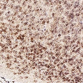 Nanog was detected in immersion fixed frozen sections of 13 d.p.c. mouse embryos using Goat Anti-Human Nanog Antigen Affinity-purified Polyclonal Antibody (Catalog # AF1997) at 1 &micro;g/mL for 1 hour at room temperature followed by incubation with the Anti-Goat IgG VisUCyte&trade; HRP Polymer Antibody (VC004). Before incubation with the primary antibody, tissue was subjected to heat-induced epitope retrieval using Antigen Retrieval Reagent-Basic (CTS013). Tissue was stained using DAB (brown) and counterstained with hematoxylin (blue).  Specific staining was localized to cell  nuclei in developing CNS. Staining was performed using our protocol for IHC Staining with VisUCyte HRP Polymer Detection Reagents.