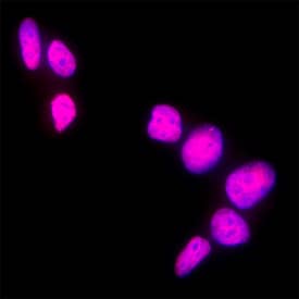 GATA‑2 was detected in immersion fixed SH‑SY5Y human neuroblastoma cell line using Goat Anti-Human/Mouse GATA‑2 Antigen Affinity-purified Polyclonal Antibody (Catalog # AF2046) at 5 &micro;g/mL for 3 hours at room temperature. Cells were stained using the NorthernLights&trade; 557-conjugated Anti-Goat IgG Secondary Antibody (red; NL001) and counterstained with DAPI (blue). Specific staining was localized to cell nuclei. Staining was performed using our protocol for Fluorescent ICC Staining of Non-adherent Cells.