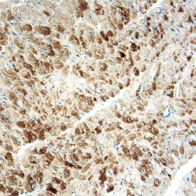 Immunohistochemistry Cathepsin F Antibody [Unconjugated]